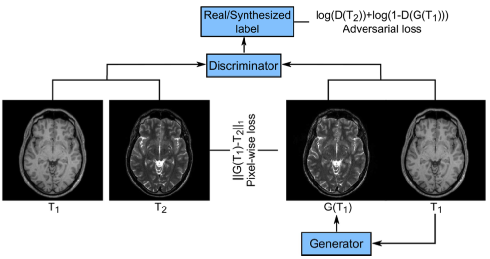 Visual overview of Image Synthesis in Multi-Contrast MRI with Conditional Generative Adversarial Networks
